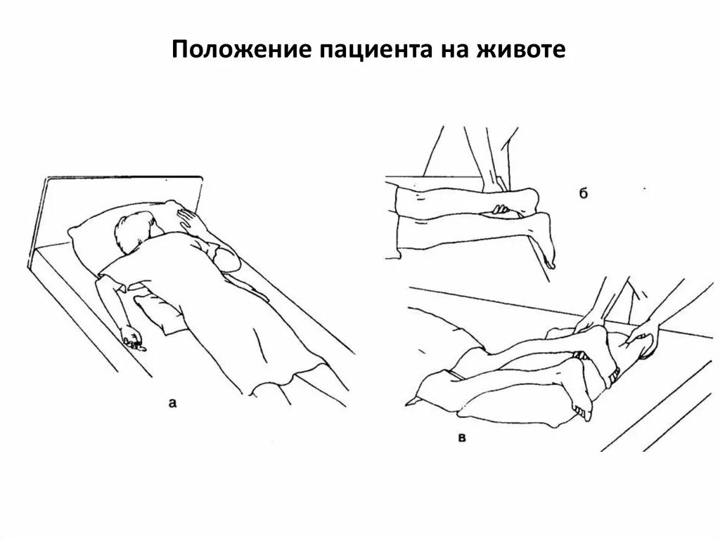 Перемещение пациента на живот. Укладывание пациента на живот. Положение лежа на животе алгоритм. Положение на животе пациента в постели.