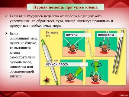 Первая помощь при укусах клещами