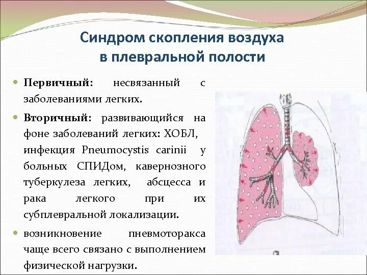 Скопление крови в плевральной полости. Скопление воздуха в плевральной полости. Синдром скопления воздуха в полости плевры. Воздух в плевральной полости. Синдром скопления воздуха в плевральной полости.