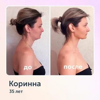 Всегда напряженное лицо