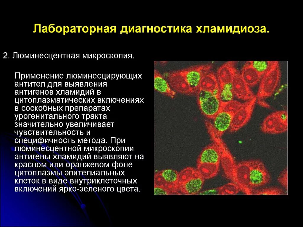 Хламидиоз 2. Хламидии люминесцентная микроскопия. Флуоресцентная микроскопия микробиология хламидиоз. Люминесцентная микроскопия микробиология. Хламидии лабораторная диагностика.