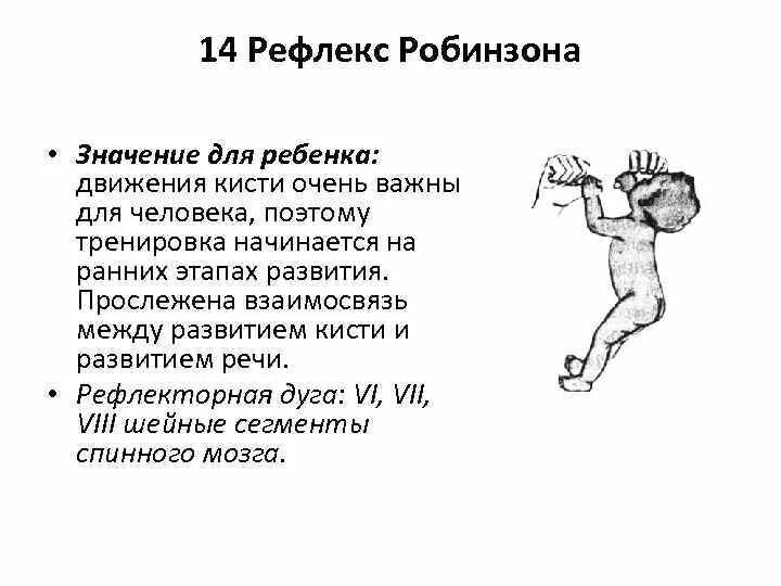 Как подавить рефлекс. Рефлекс Робинзона у новорожденных. Рефлексы новорожденного рефлекс Робинсона. Хватательный рефлекс Робинзона. Хватательный рефлекс у новорожденных.