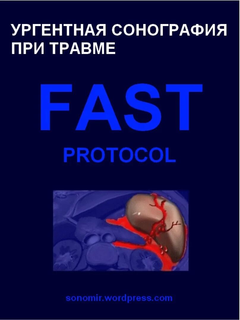 Фаст протокол УЗИ при травме. Ургентная сонография при травме fast-протоколы. Fast протокол УЗИ при травме. Fast протокол