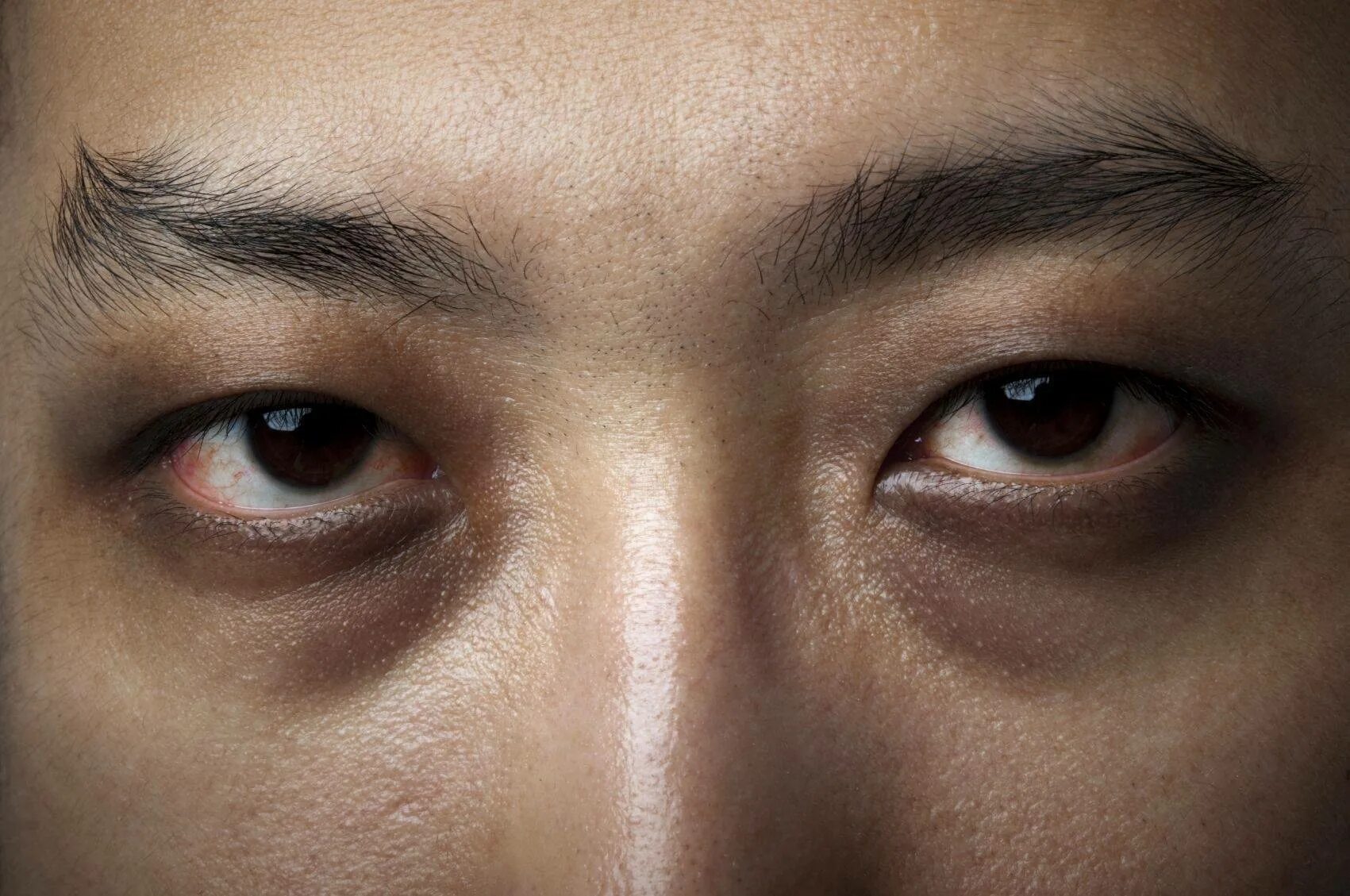 Узкие глаза признак. Черные глаза мужские. Узкие глаза мужские. Человек с темными кругами под глазами. Азиатские глаза.
