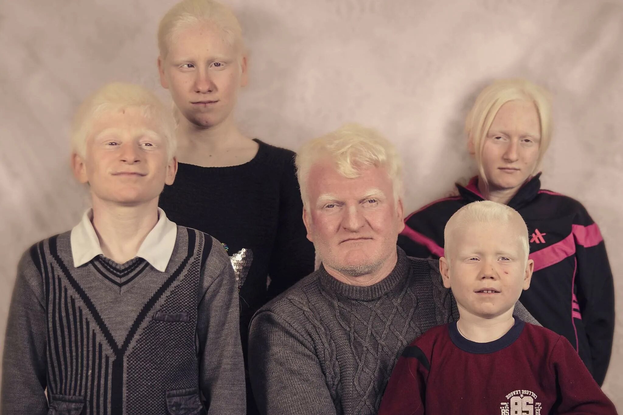 Йорк альбинос