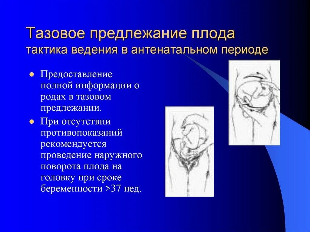 Тазовое предлежание матки. Предлежание плода. тазовое положение. при тазовом предлежании плода.