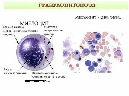 Клетки с дегенеративными изменениями в цитологии