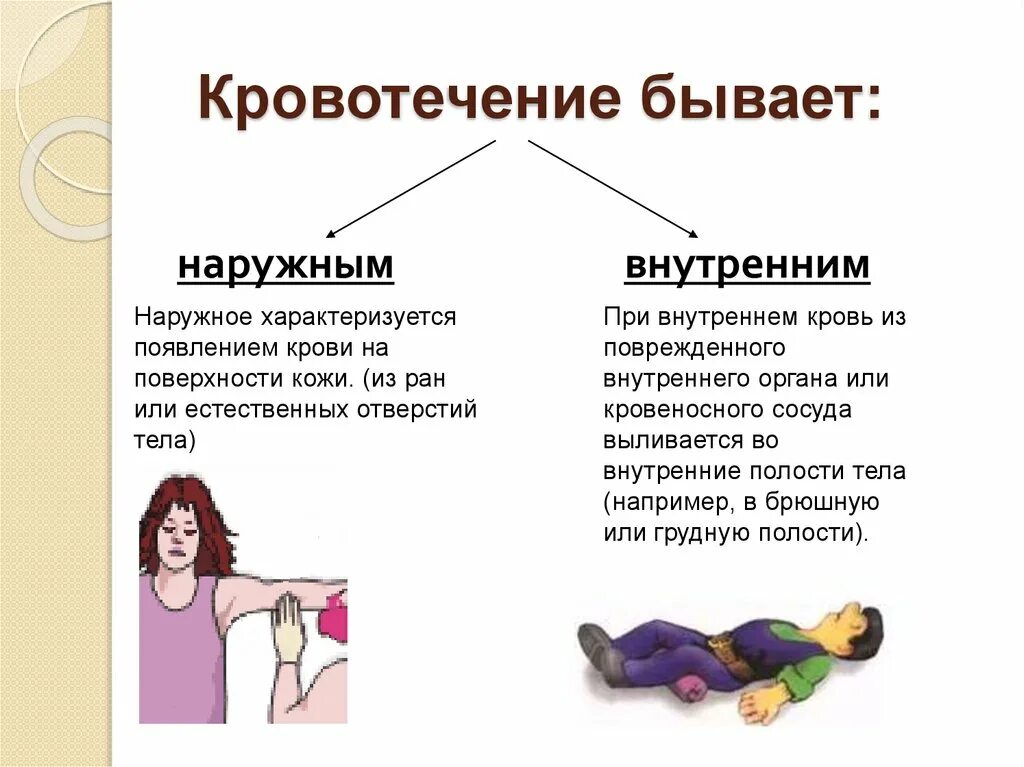 Внутреннее кровоточат. Разновидности внутреннего кровотечения. Наружные внутренние и скрытые кровотечения. Симптомы внутреннего кровотечения. Наружное и внутреннее кровотечение.