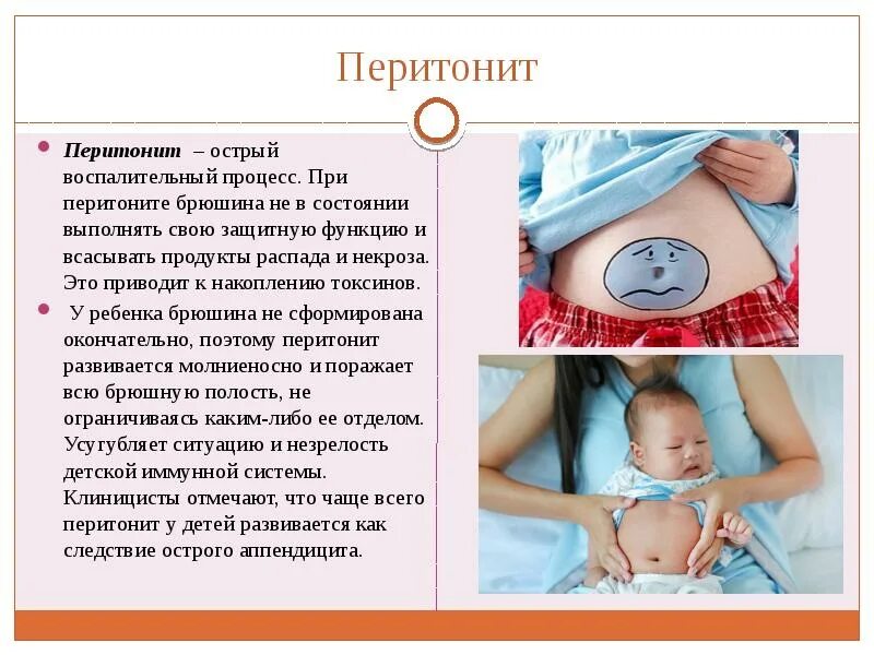 Острый серозный перитонит. Перитонит живота признаки. Перитонит живота признаки. Патогенез акушерского перитонита. Клинические проявления перитонита.