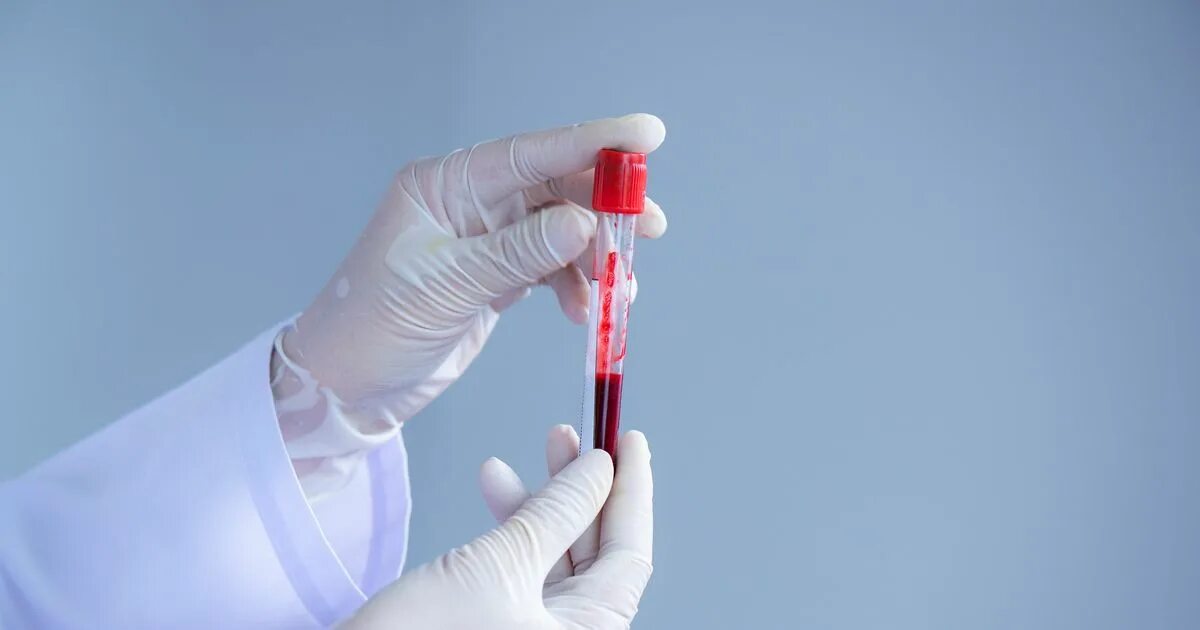 Кровь в пробирке. Эритроциты. Kan al. Пробирка с кровью на белом фоне. Kan al.