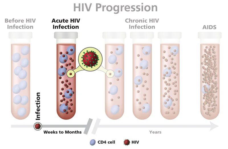 AIDS cd4 infection Prophylaxis. HIV infection tolerance. Stages of HIV. Human immunodeficiency virus 1