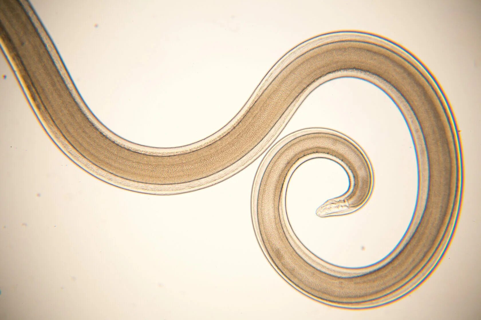 Человеческая аскарида круглый червь. Человеческая аскарида Ascaris lumbricoides.
