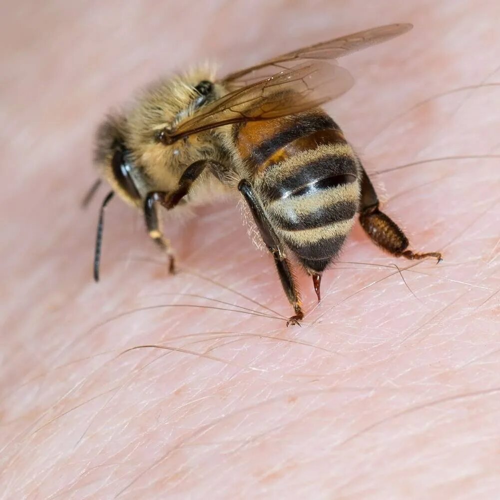 Being stung by a bee