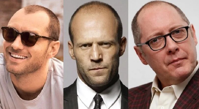 Dump A Day Male Baldness, Together We Can Over Comb It - 24 Pics Bad haircut, Th