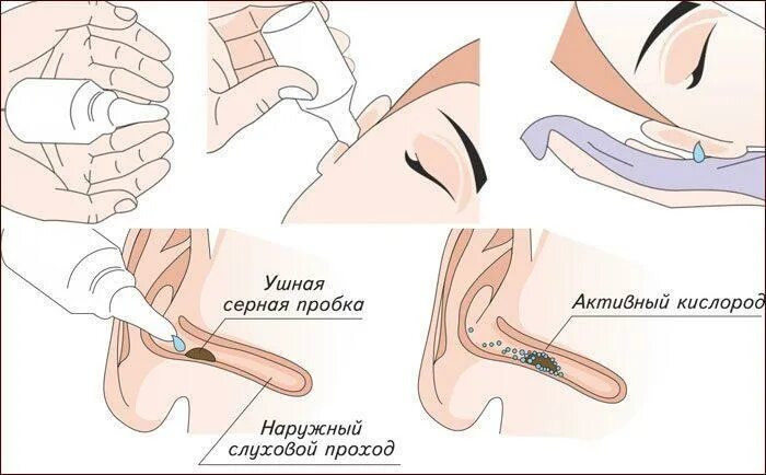 Почему стук в ухе. Шум в левом ухе. Шум звон в ушах причины. Постоянный шум в левом ухе. Почему звенит в ушах.