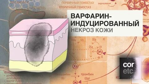 Как убрать некротическую ауру