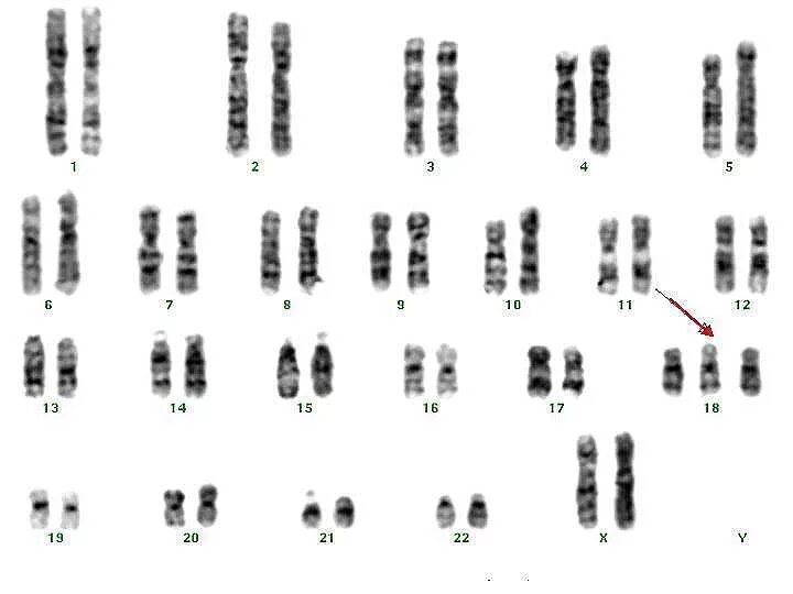 Соматические хромосомы. Хромосомы мыши. Сходство хромосом человека и мыши. Кариотип мыши. Количество хромосом у мыши.