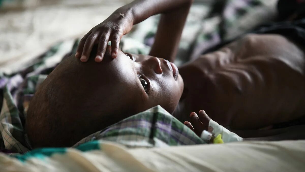 Боль от голода. Голодающие истощенные дети Африки.