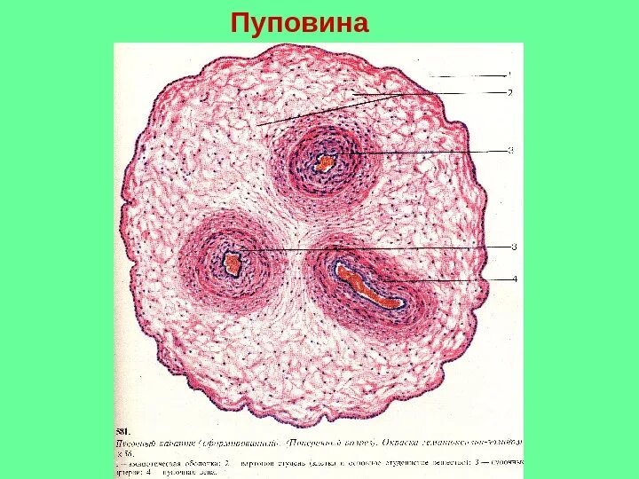 Строение пупочного канатика гистология. Строение пуповины гистология. Пуповина гистология препарат. Пуповина свиньи поперечный срез.