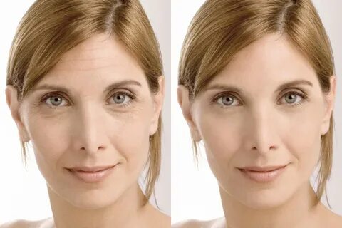 Face comparison