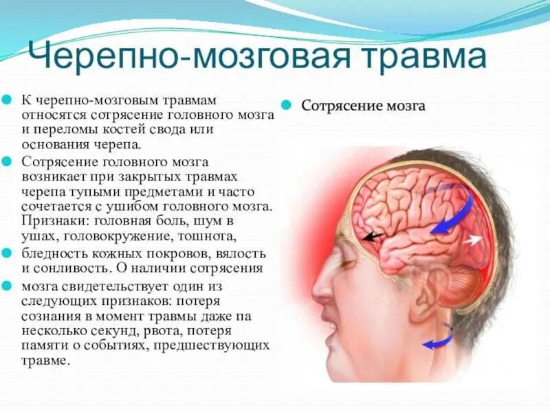 Симптоматика сотрясения головного мозга обуславливается. Три основных признака при сотрясении головного мозга.. Черепно мозговая травма ушиб мозга. Сеоепно мозгоапя Травиа. Средство при травме головы