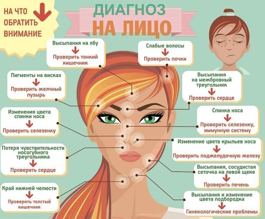 Прыщи на лице по зонам. Прыщи на лице причины по зонам у женщин. Локализация высыпаний на лице.