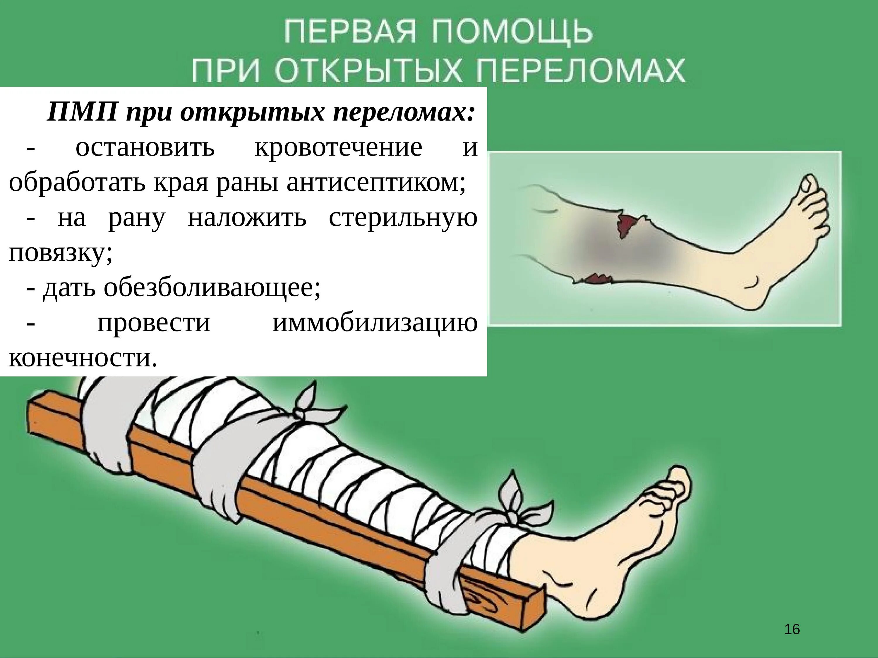 Первая помощь при открытых и закрытых переломах. Первая мед помощь при травмах и повреждениях. ПМП при переломах опорно двигательных аппаратов. Принципы первой помощи при открытых повреждений. Первая медицинская помощь при травмах опорно-двигательного аппарата.