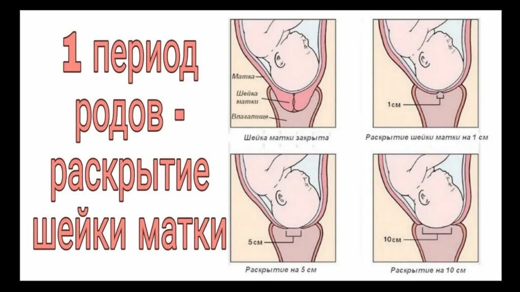 Раскрытие шейки при родах. Раскрытие шейки матки при родах периоды. Шейка готова когда роды