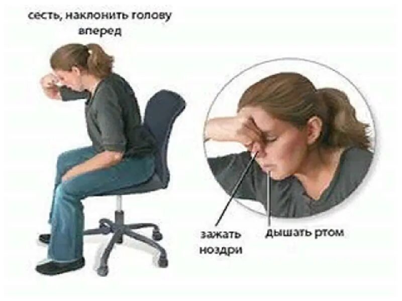 Можно ли прищемить