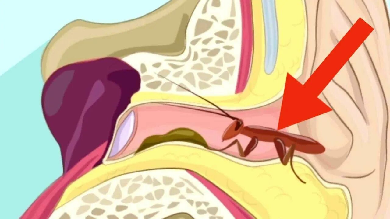 Как быстро почистить ухо
