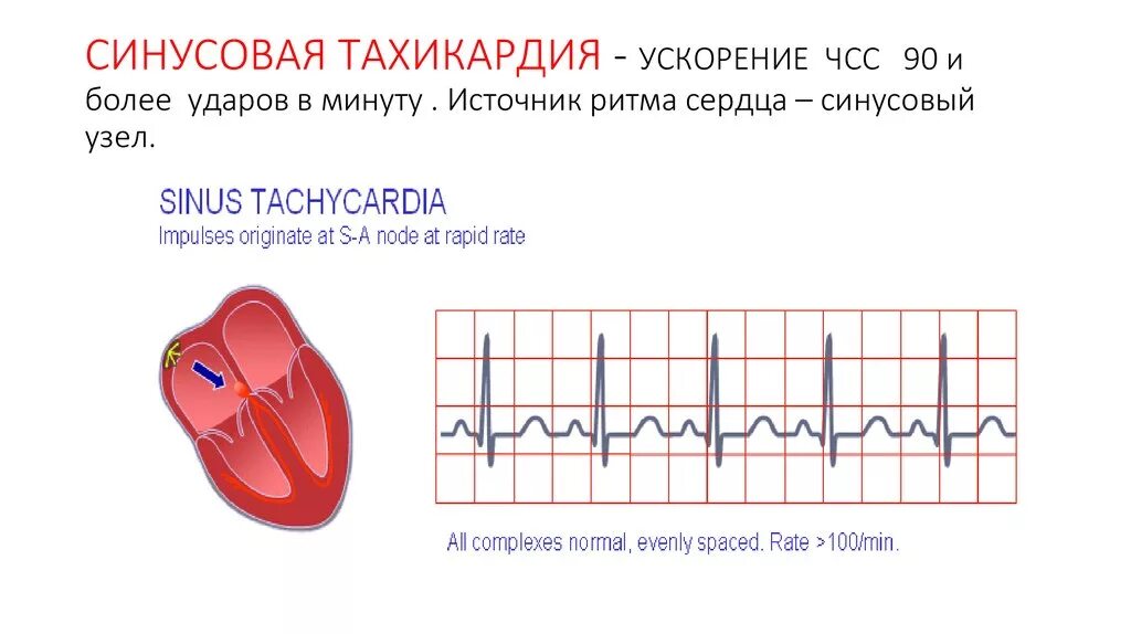 Аритмия норма пульса