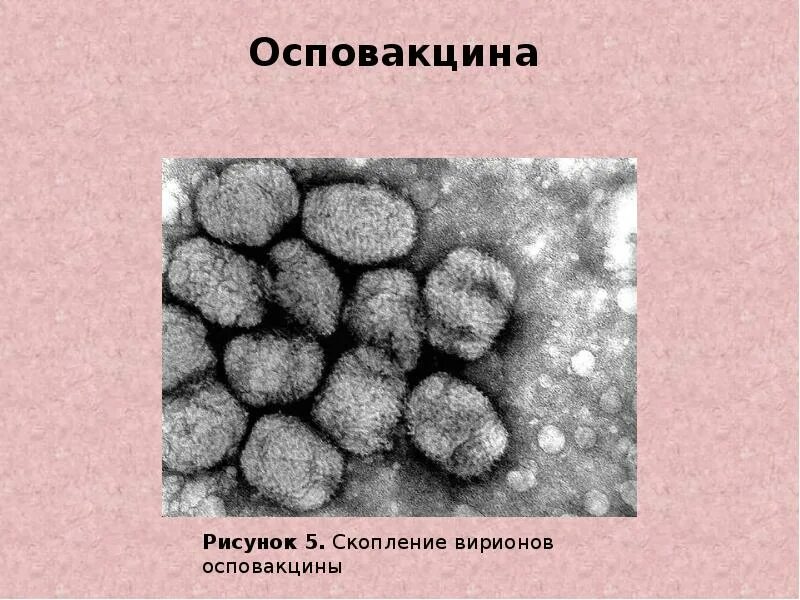 Аденовирус вирус вирион. Вирионы вич под микроскопом. Вирус reoviridae. Электронная фотография вируса. Вирион как выглядит.