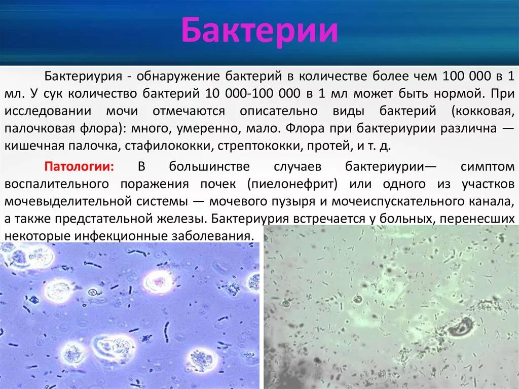 Бактериурия микроскопия. Бактерии в моче. Микроорганизмы в моче. Бактерии в осадке мочи. Слизь единичные