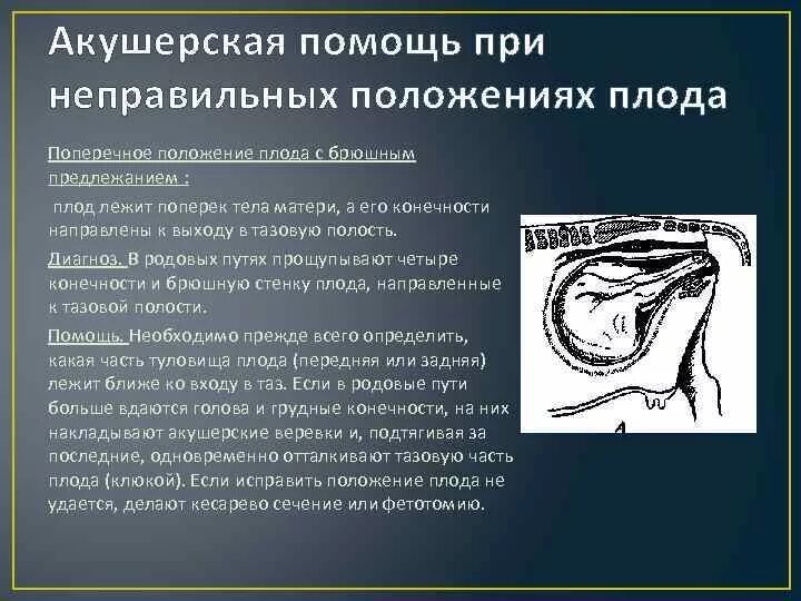 Положение плода акушерское. Поперечное положение плода осложнения. Неправильное положение плода. Неправильное положение плода поперечное. Причины возникновения неправильного положения плода.