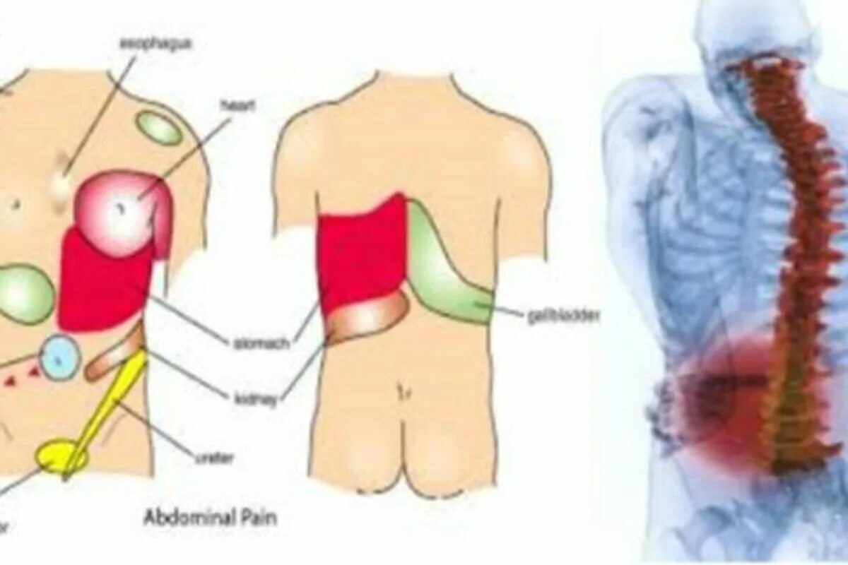 Боль в левом ребре и спине. Болит правая сторона спины. Болит левая сторона.