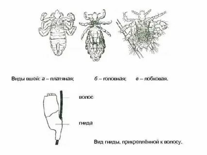 Виды вшей