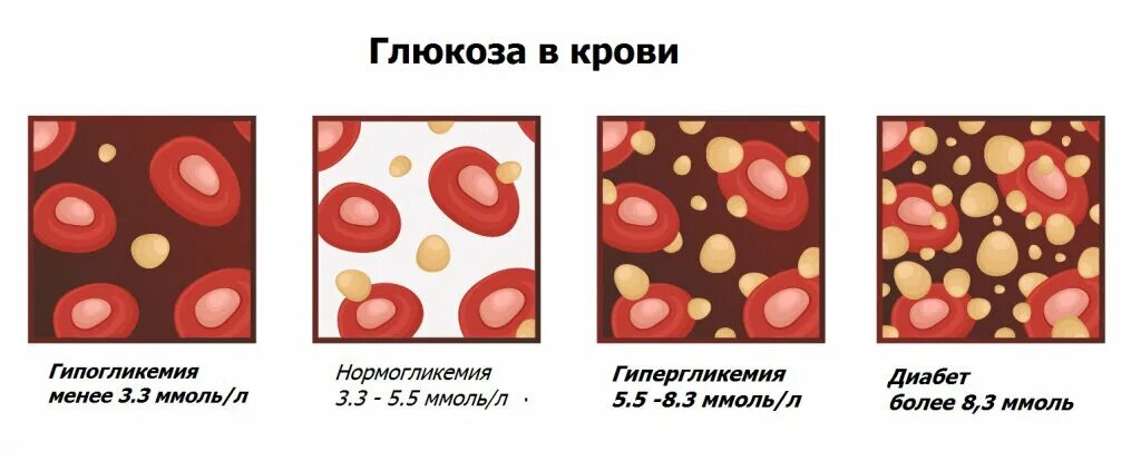 Глюкоза в крови. Сахар в крови. Повышенный Глюкоза в крови. Глюкоза повышает сахар в крови. Много глюкозы в крови