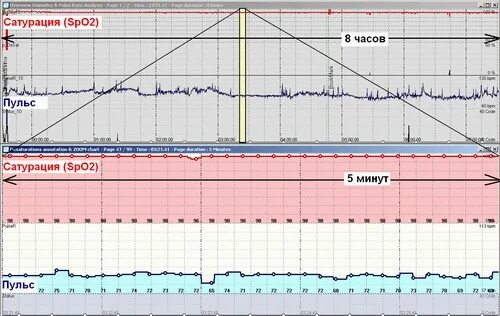 Сатурация во время сна. Причины падения сатурации. Сатурация во время сна. Сатурация во сне норма. Нормы кислорода в крови у взрослых показатели норма.