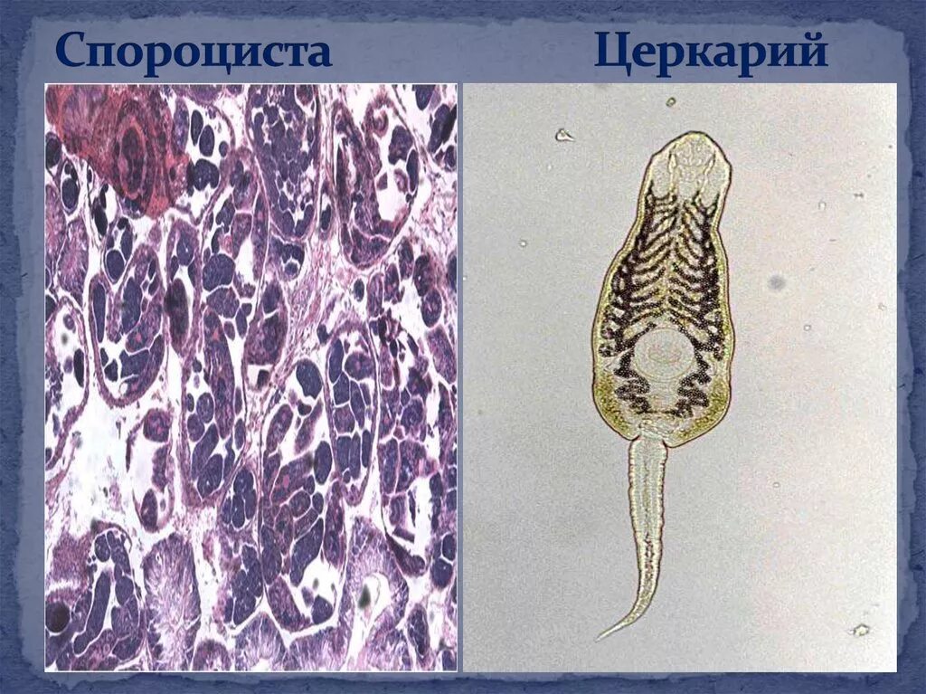 Церкарий трематод. Спороциста редия церкарий. Церкария сосальщика.