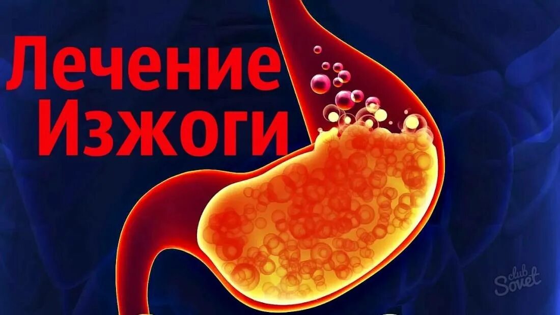 Что можно пить при изжоге