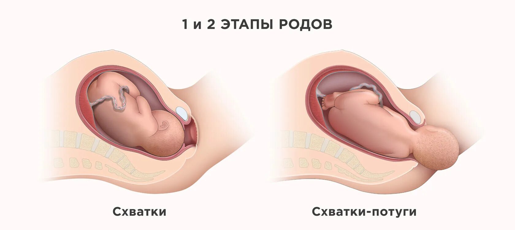 Этапы родовой деятельности. Роды этапы родовой деятельности. Первые роды этапы