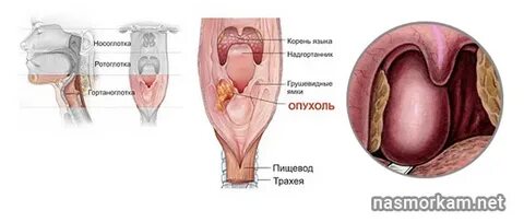 При глотании как будто что то мешает
