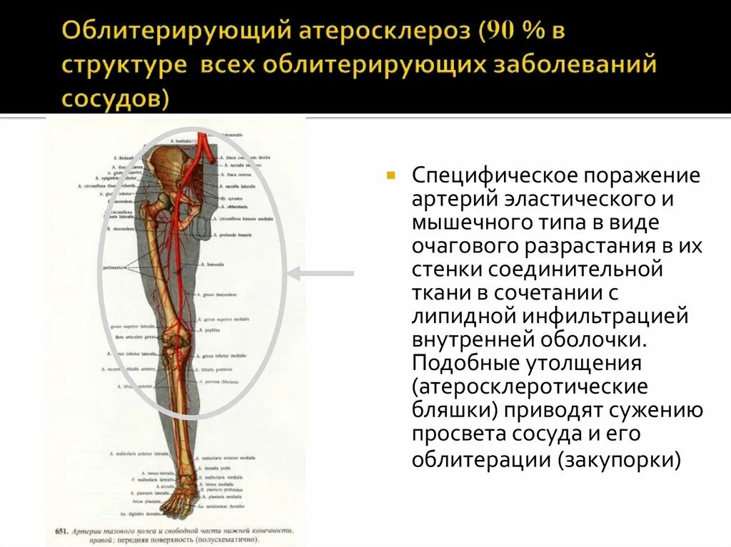 Артерий атеросклероз латынь. Осложнение атеросклероза бедренных артерий. Атеросклероз артерий конечностей осложнения. Осложнения облитерирующего атеросклероза нижних. Облитерирующий атеросклероз нижних конечностей жалобы.