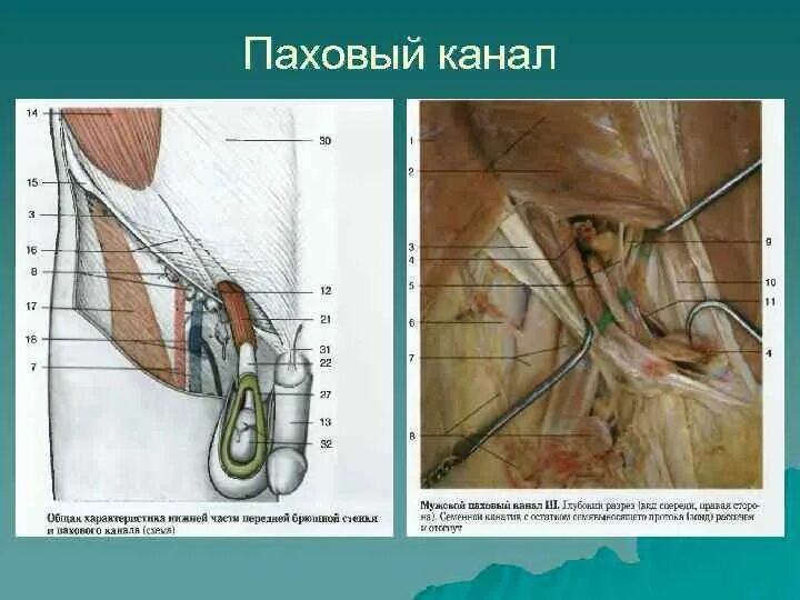 Чему соответствует внутреннее кольцо пахового канала: найдено 89 изображений