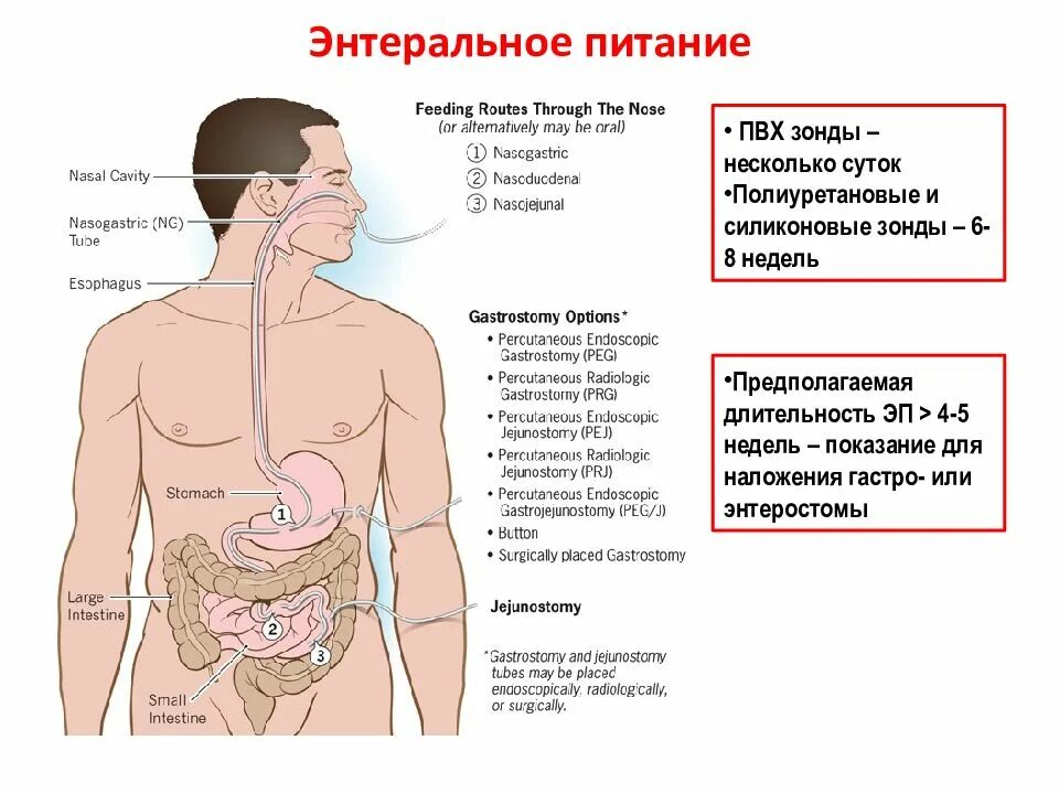 Энтеральное через рот. Энтеральное питание. зондовое энтеральное питание. клиническое энтеральное питание. способы энтерального питания.