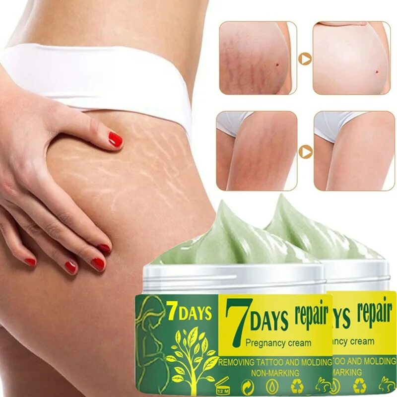 Stretch mark cream. Крем от растяжек для беременных. Крем от растяжек стрейч Маркс. Крем от растяжек в аптеке.