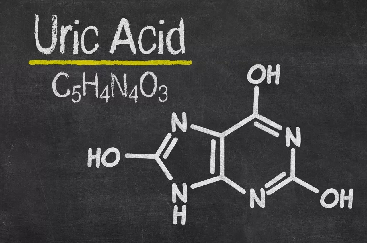 Мочевая кислота (uric acid). Мочевая кислота формула структурная. Формула мочевой кислоты биохимия. Мочевая кислота формула химическая. Много кислоты в крови