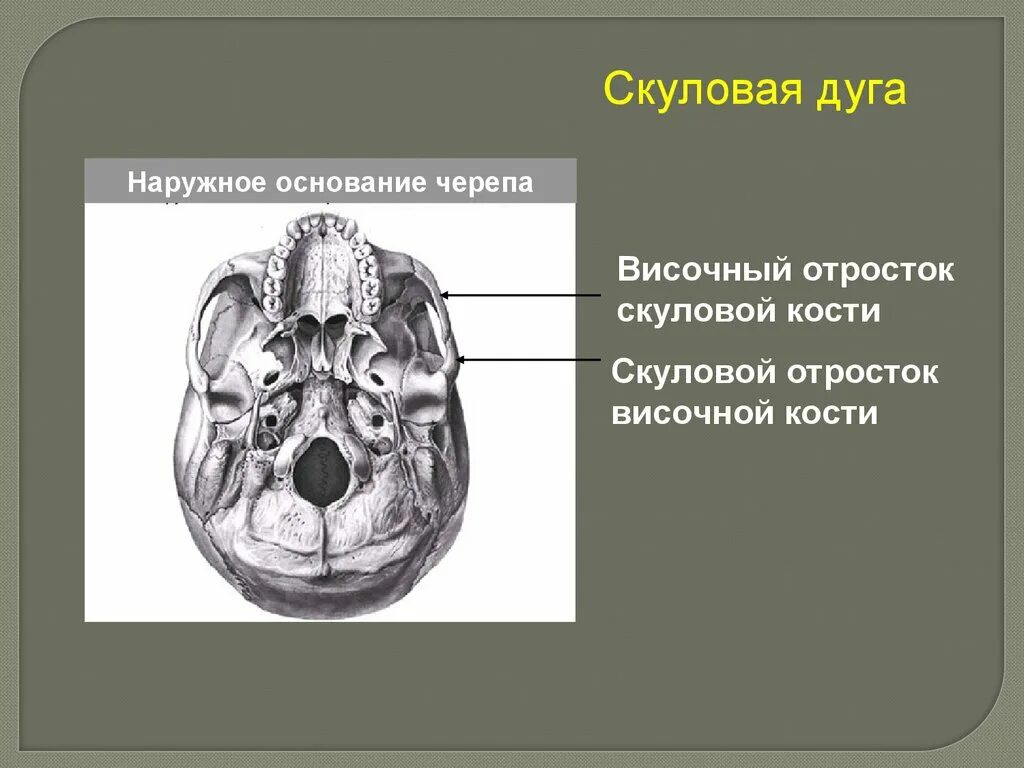 Хоаны анатомия черепа. Анатомия хоаны основания черепа. Кости основания черепа анатомия. Скуловая дуга анатомия человека. В полости черепа расположен