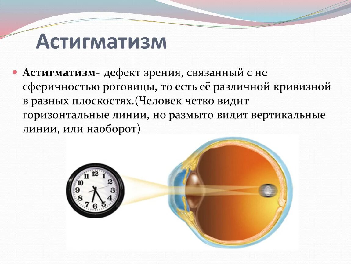 Астигматизм диоптрии. Астигматизм 1.0 диоптрий. Зрение 2.5 астигматизм. Астигматизм 1.7.