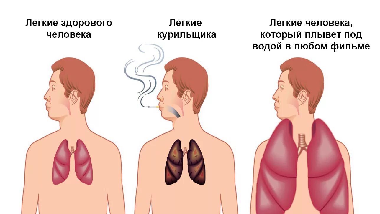 Легкие человека курильщика. Лёгкие здорового человека и вейпера. От вейпа есть рак